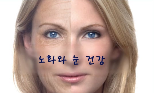 노화와 눈 건강