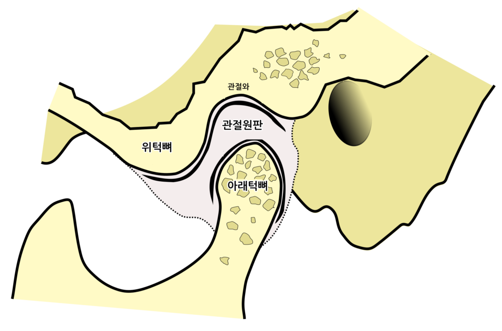 턱관절의 해부학