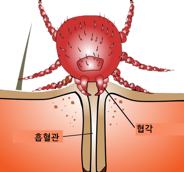 털진드기흡혈