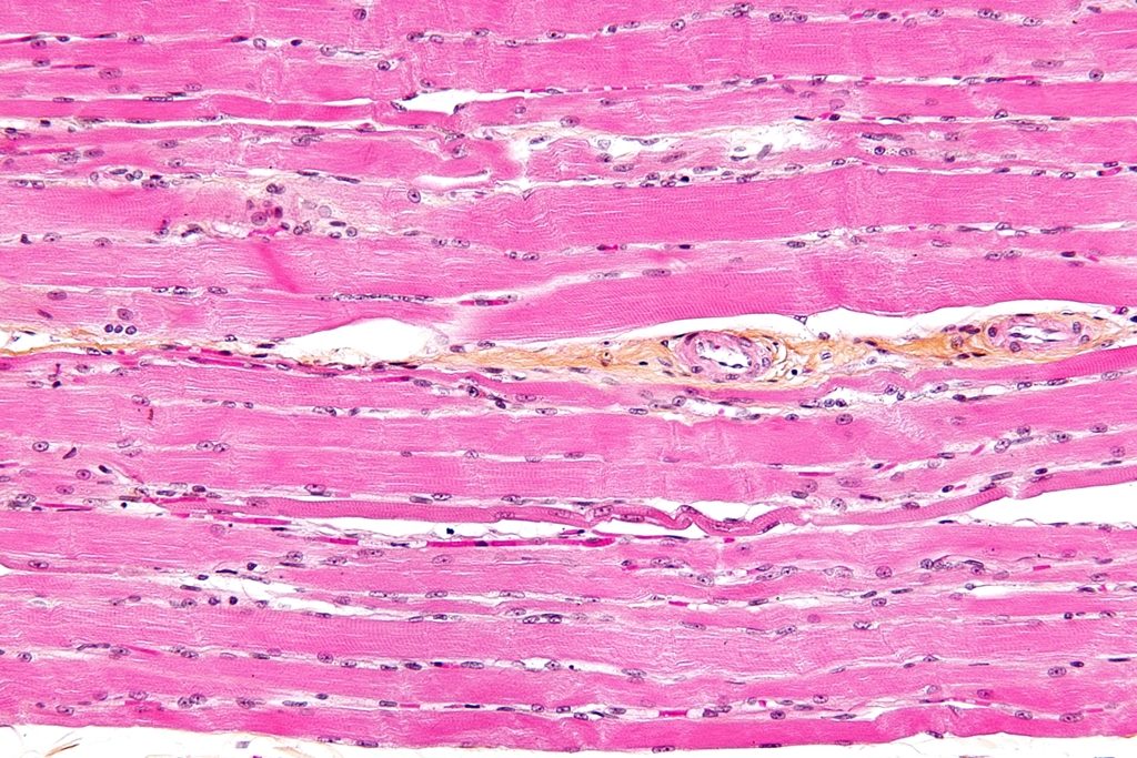 Skeletal_striated_muscle